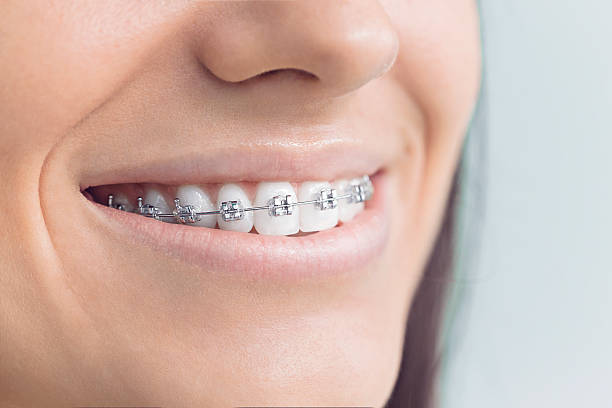 Best Wisdom Tooth Removal  in Buckhall, VA